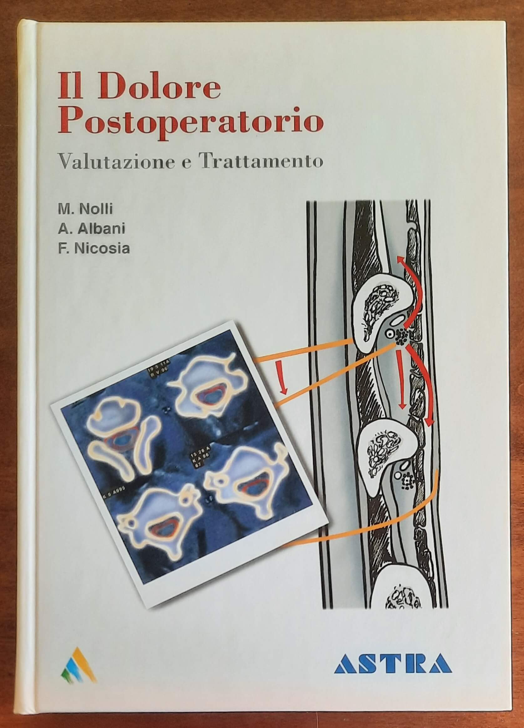 Il Dolore Postoperatorio. Valutazione e trattamento