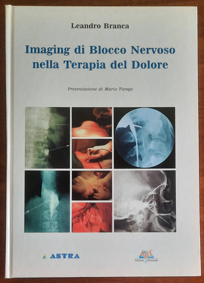 Imaging di Blocco Nervoso nella Terapia del Dolore