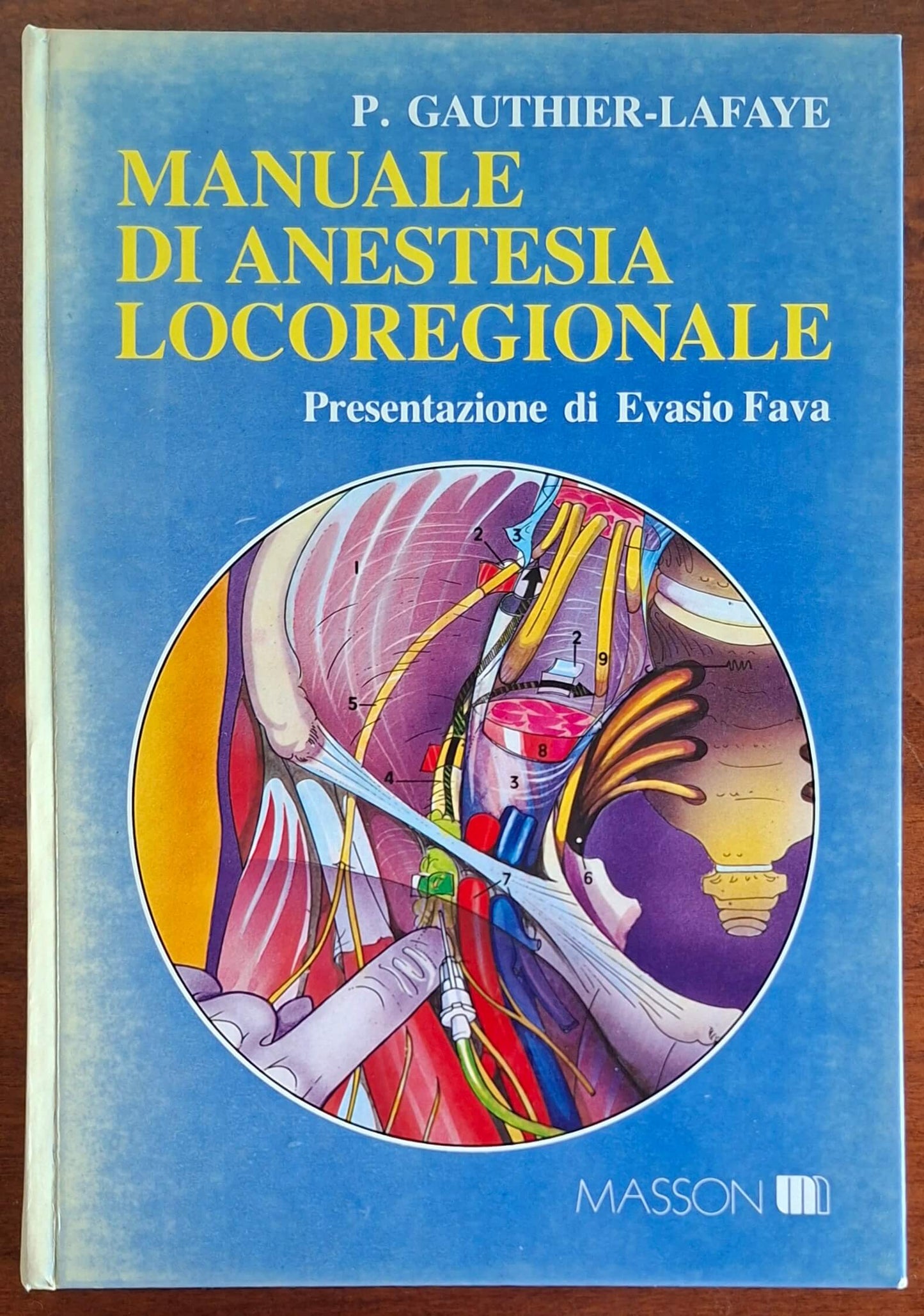 Manuale di anestesia locoregionale - P. Gauthier-Lafaye - Masson
